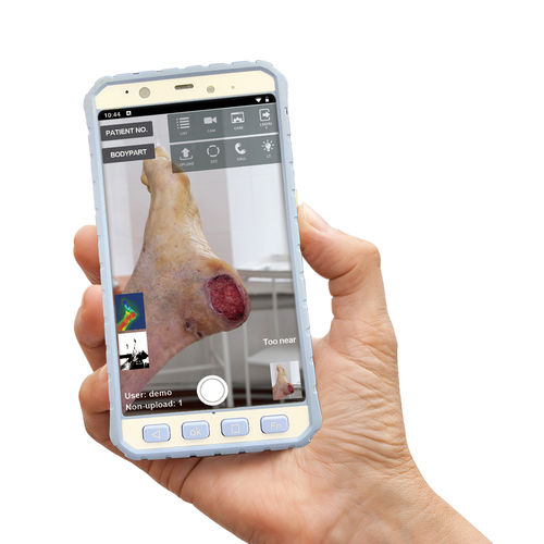 Applicazione iOS di analisi - MPD100 - Medimaging Integrated Solution - per cartelle cliniche elettroniche / di pelle / con intelligenza artificiale