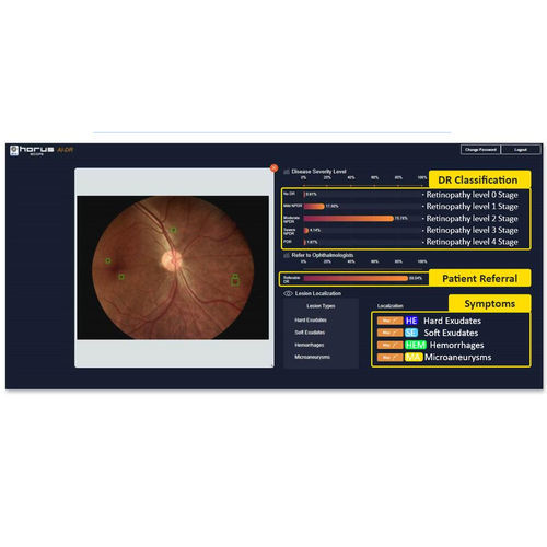 Software di oftalmoscopia - Medimaging Integrated Solution - di analisi delle immagini / screenin gdella retinopatia diabetica / con intelligenza artificiale