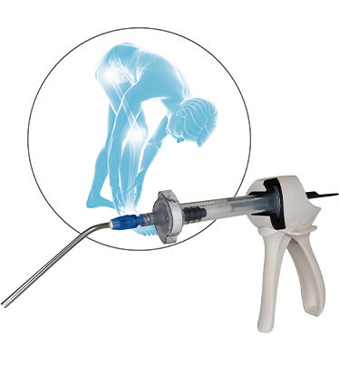 Sostituto osseo sintetico - QUICKSET® - NORAKER - per chirurgia ortopedica / conformabile / pasta