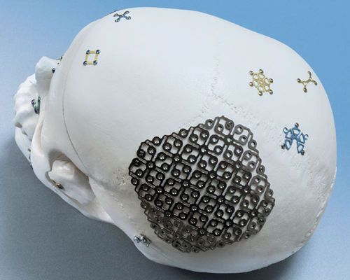 Sistema di fissazione cranica non assorbibile - OPTIMUS - OSTEONIC