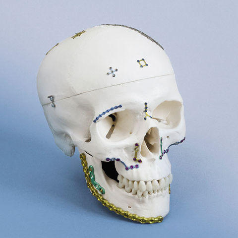 Placca di compressione per mandibola - OPTIMUS - OSTEONIC - non bloccata / in metallo