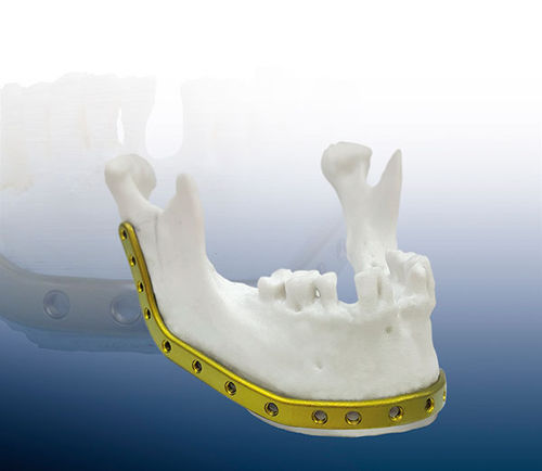 Placca di compressione per mandibola - REAL FIT - OSTEONIC - bloccata / in titanio