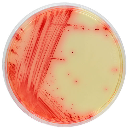 Mezzo reattivo - MB640 - CHROMagar - clinico / da laboratorio / del micoplasma