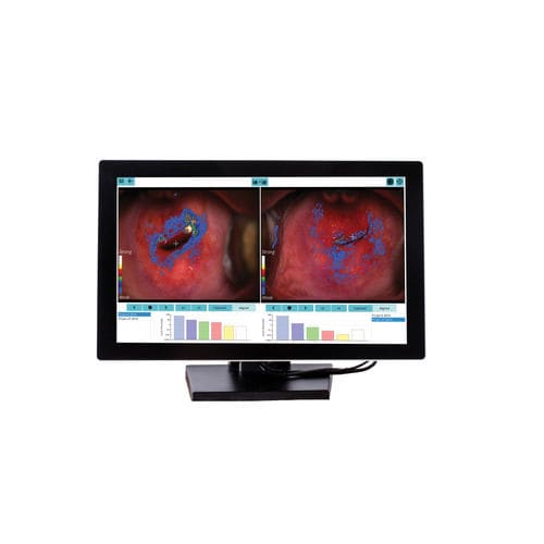 Software di analisi - DYSISmap - DySIS Medical - di gestione / didattico / di valutazione