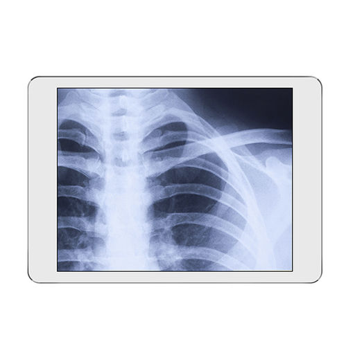 Sistema di acquisizione per radiografia - iRay DR - iRay Technology - portatile