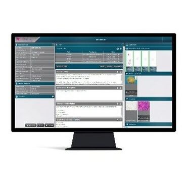 Sistema informativo per laboratorio di istopatologia - CaseManager DX - 3DHISTECH Ltd. - di gestione