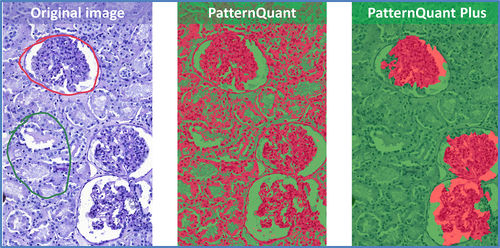 Software medico - QuantCenter - 3DHISTECH Ltd. - clinico / da ricerca / di analisi