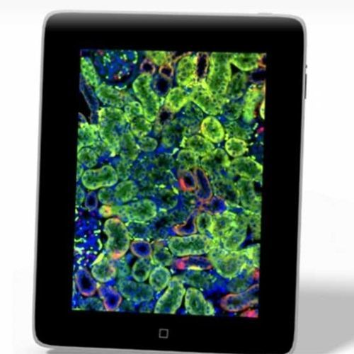 applicazione iOS diagnostica - 3DHISTECH Ltd.