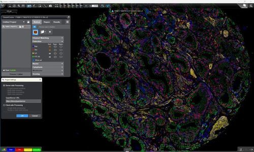 Piattaforma AI per ospedali - QuantServer - 3DHISTECH Ltd. - per diagnostica per immagini / per laboratorio di istopatologia / per ricerca medica
