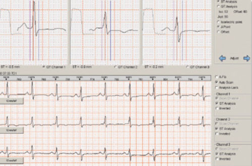 Software per Holter cardiaco - Braemar C1000   - Braemar - di analisi