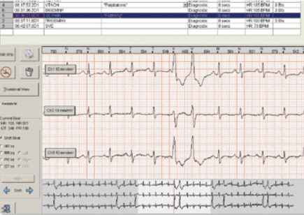 Software per Holter cardiaco - Braemar C3000 - Braemar - di analisi / di gestione dati / di progettazione