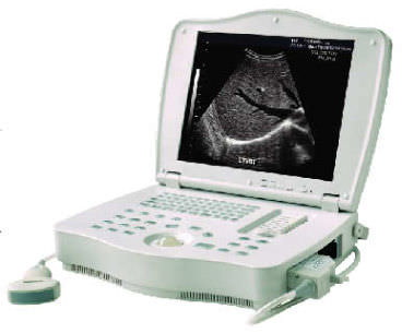 Ecografo portatile - LEO-3000E1  - Xuzhou Leo Medical Equipments - per ecografia multidisciplinare / in bianco e nero / con console integrata