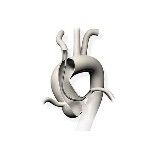 Catetere di guida - Profit™ - Nipro - aortico / 6 Fr