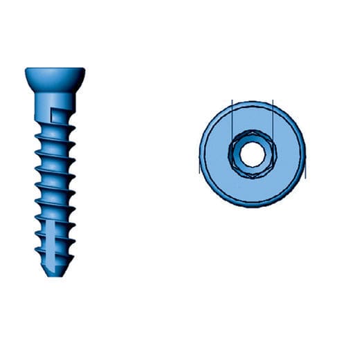 Vite per compressione ossea per epifisi - 36.241 series - Medicalex - canalare / in titanio / bloccata