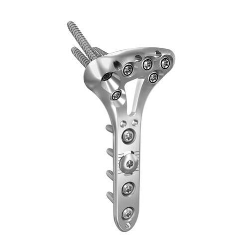 Placca di compressione per radio - ANTHEM® - Globus Medical - per polso / distale / bloccata