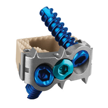 Gabbia intersomatica cervicale - COALITION® - Globus Medical - via anteriore / con placca ossea cervicale