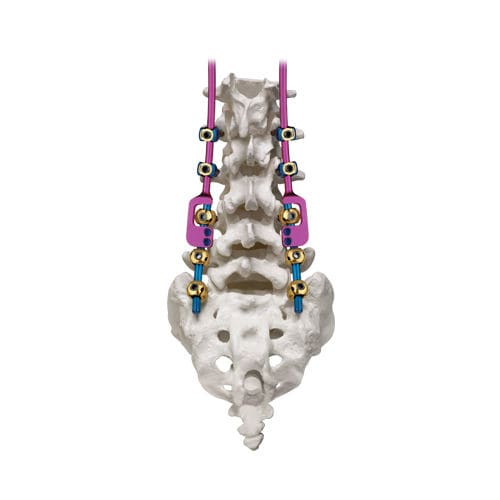 Sistema di osteosintesi toraco-lombo-sacrale - REVERE® ADDITION® - Globus Medical - via posteriore / per adulti