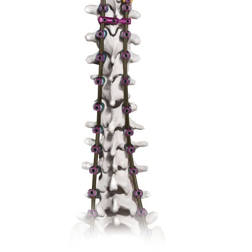 Sistema di osteosintesi toraco-lombo-sacrale - CREO AMP® - Globus Medical - via posteriore / per adulti