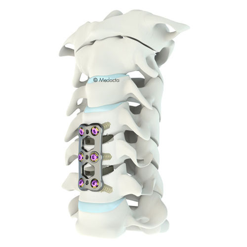 Placca per artrodesi cervicale - Mecta®-C  - Medacta - bloccata / in metallo