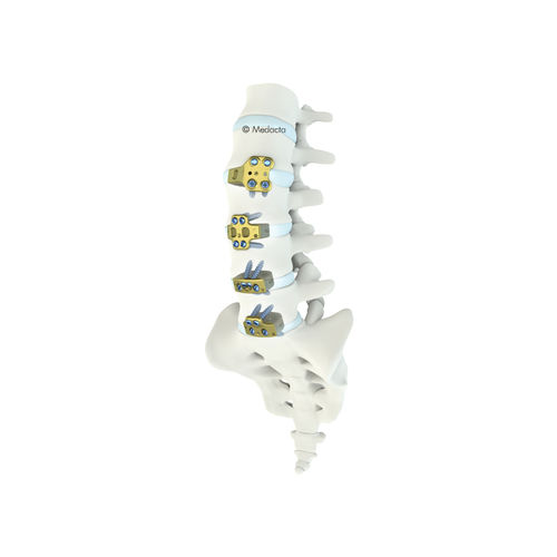 Gabbia intersomatica toraco-lombare - MectaLIF® - Medacta - via anteriore / in titanio