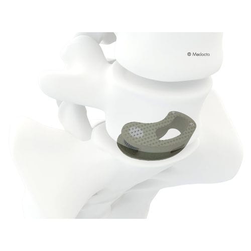 Gabbia intersomatica lombare - MectaLIF® - Medacta - via transforaminale / in titanio / in PEEK