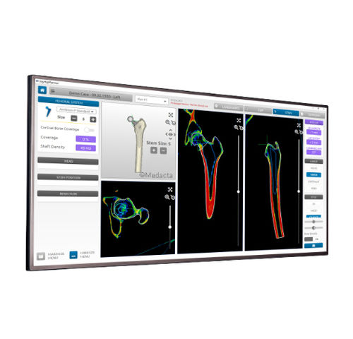 Software per tomografia computerizzata - MyHip® - Medacta - di analisi / di pianificazione / di anca