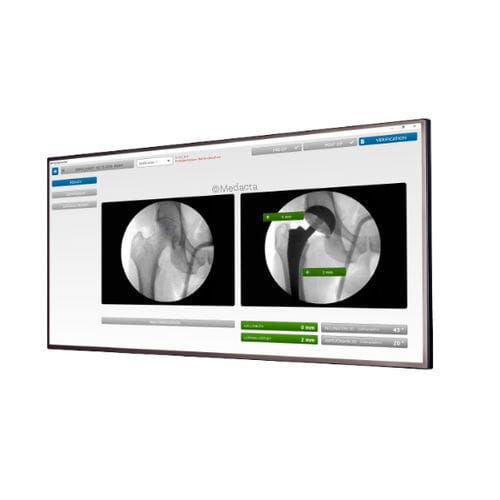 Software per chirurgia dell'anca - MyHip® - Medacta - di verifica / di anca / per tablet PC