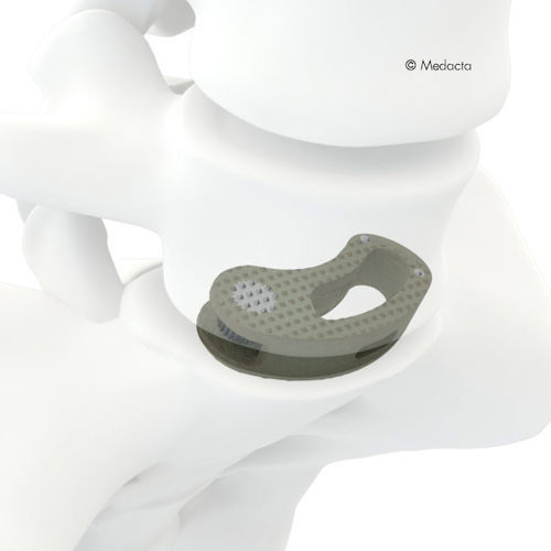 Gabbia intersomatica toraco-lombare - MectaLIF® - Medacta - via obliqua / in titanio / in PEEK
