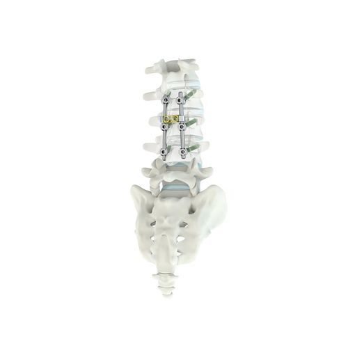Sistema di osteosintesi toraco-lombare - M.U.S.T.® MC - Medacta - via posteriore / per adulti
