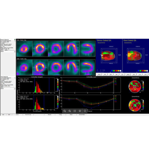 Software di analisi - InterView™ XP - Mediso - di visualizzazione / diagnostico / di misura