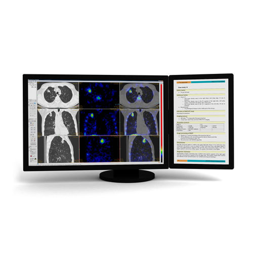 Software medico - InterView™ FUSION - Mediso - per diagnostica per immagini / di visualizzazione / di valutazione