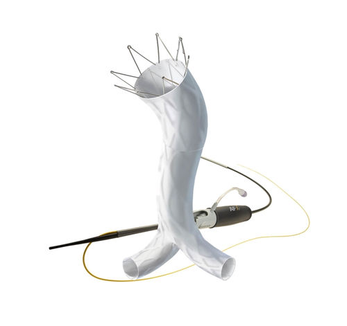 Innesto stent aorta addominale - AFX®  - Endologix - in ePTFE