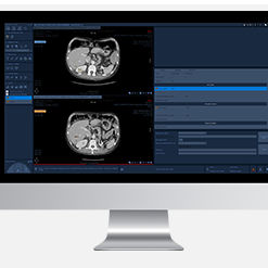Modulo software di oncologia - Myrian® XL-Onco - Intrasense - medico / per tomografia computerizzata / di analisi