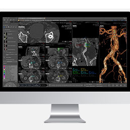 Modulo software medico - Myrian® XP-Vessel - Intrasense - di analisi / di visualizzazione / di pianificazione