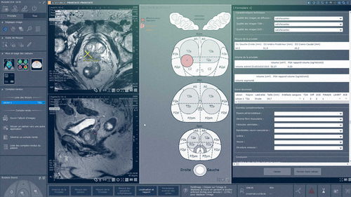 Modulo software MRI - Myrian® XP-Prostate - Intrasense - per ecografia / di analisi / di visualizzazione