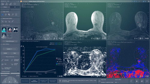 Modulo software medico - Myrian® XP-Breast - Intrasense - per mammografia / di analisi / di visualizzazione