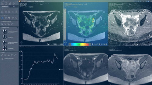 Modulo software clinico - MYRIAN®XP-FEMALE - Intrasense - di analisi / di visualizzazione / di pelvi