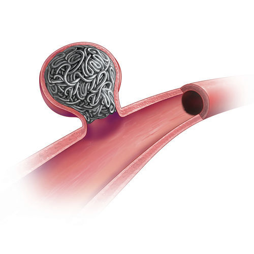 Spirale per embolizzazione staccabile - Ruby® - Penumbra