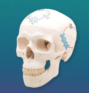 Sistema di fissazione cranica non assorbibile - NeuroPro®  - Kinamed