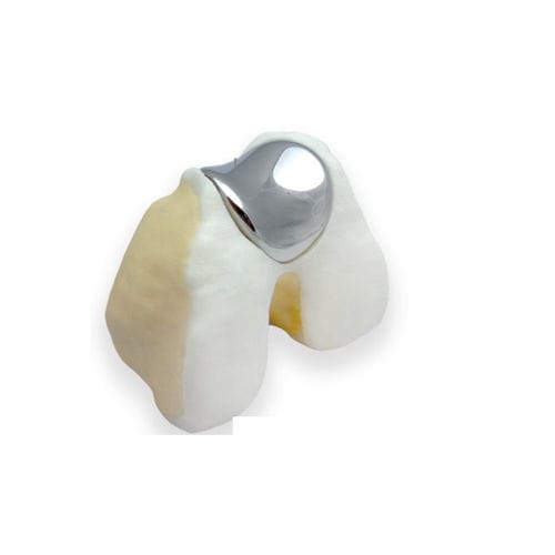 Protesi femoro-rotulea - KineMatch® - Kinamed