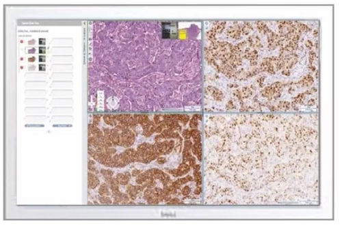 PACS per diagnostica per immagini - Aperio eSlide Manager - Leica Biosystems - per ospedale / medico / clinico