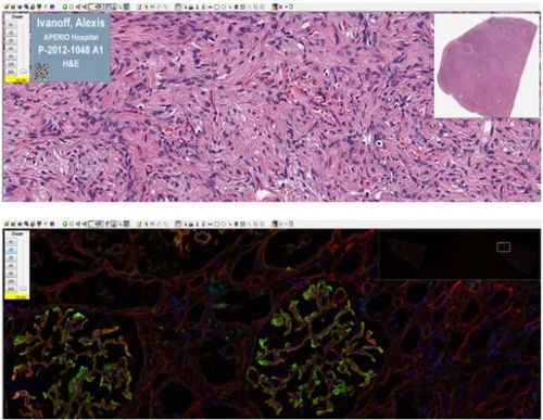 Software di analisi delle immagini - Aperio ImageScope - Leica Biosystems - medico / per laboratorio di istopatologia
