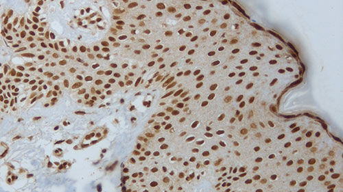 Mezzo reattivo - akt-phosphorylated - Leica Biosystems - per immunoistochimica / liquido / per antigeni