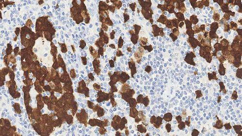 Reagente anticorpo - ALK-L-CE-H - Leica Biosystems - anticorpo monoclonale / per immunoistochimica / per istopatologia