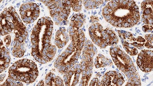 Reagente anticorpo monoclonale - AMACR-L-CE - Leica Biosystems - anticorpo / per immunoistochimica / liquido