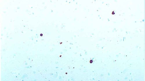 Reagente anticorpo monoclonale - ASYN-L - Leica Biosystems - anticorpo / per immunoistochimica / per western blot