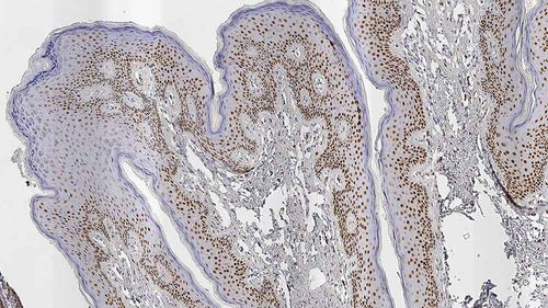 Reagente anticorpo monoclonale - AR27 - Leica Biosystems - anticorpo / per istopatologia / per immunoistochimica