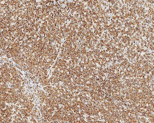 Reagente anticorpo - Bcl-2  - Leica Biosystems - anticorpo monoclonale / per tessuti / per immunoistochimica