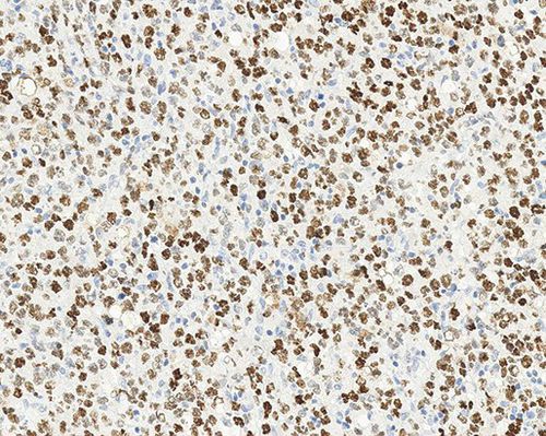 Reagente anticorpo - Bcl-6  - Leica Biosystems - anticorpo monoclonale / da ricerca / diagnostico