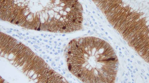 Reagente anticorpo monoclonale - B-CAT-L-CE - Leica Biosystems - anticorpo / per tessuti / per immunoistochimica